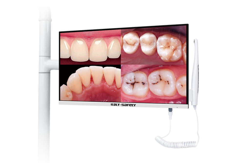 Intraoral Camera